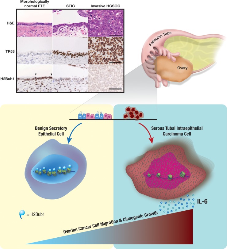 Figures demonstrating p53-dependent changes in H2B monoubiquitination at the SLC7A11 regulatory region and functional links to ferroptosis (see Figure 4 and related panels in the article).