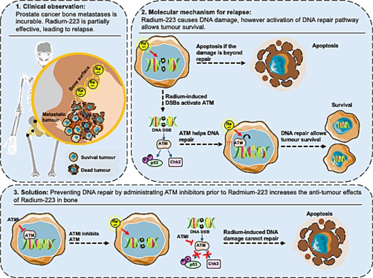 Preclinical evaluation of ATM inhibition with radium-223 in prostate-cancer bone-metastasis models.