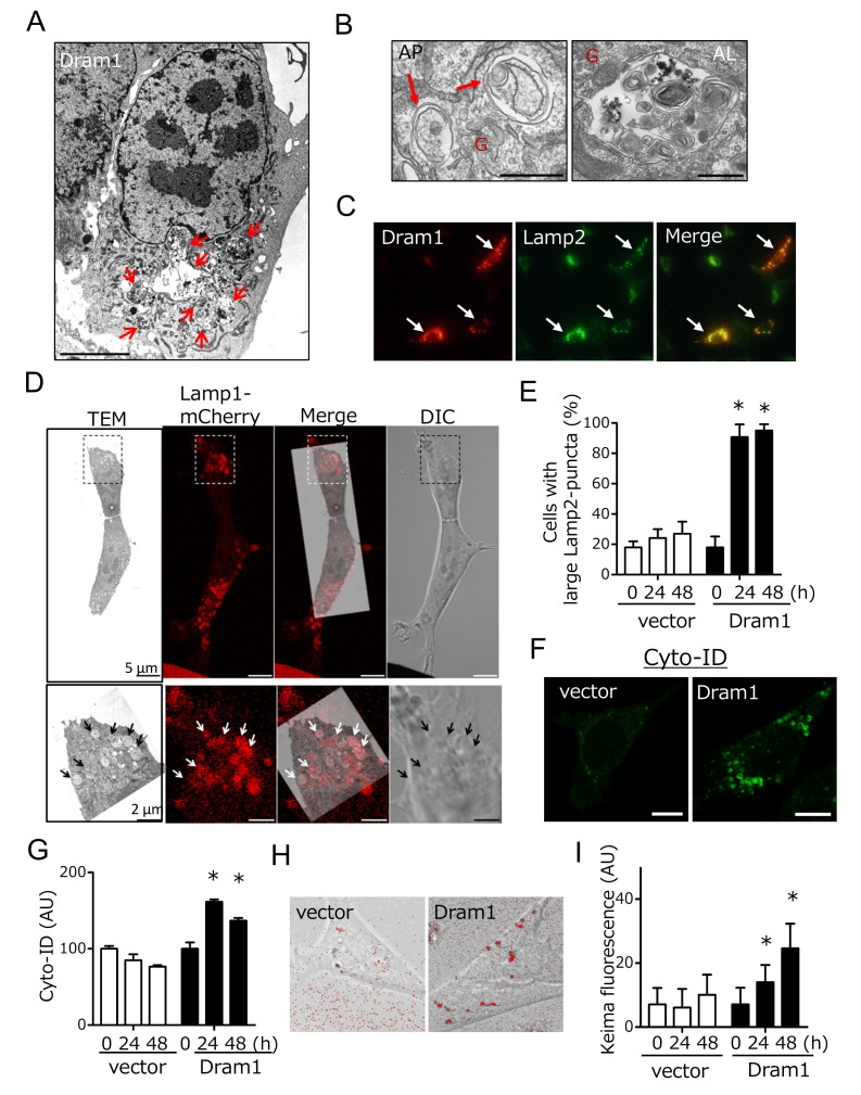 Key discovery linking p53-regulated DRAM1 to lysosome–ER contact and ER stress (figure from Wang et al., PNAS 2024).