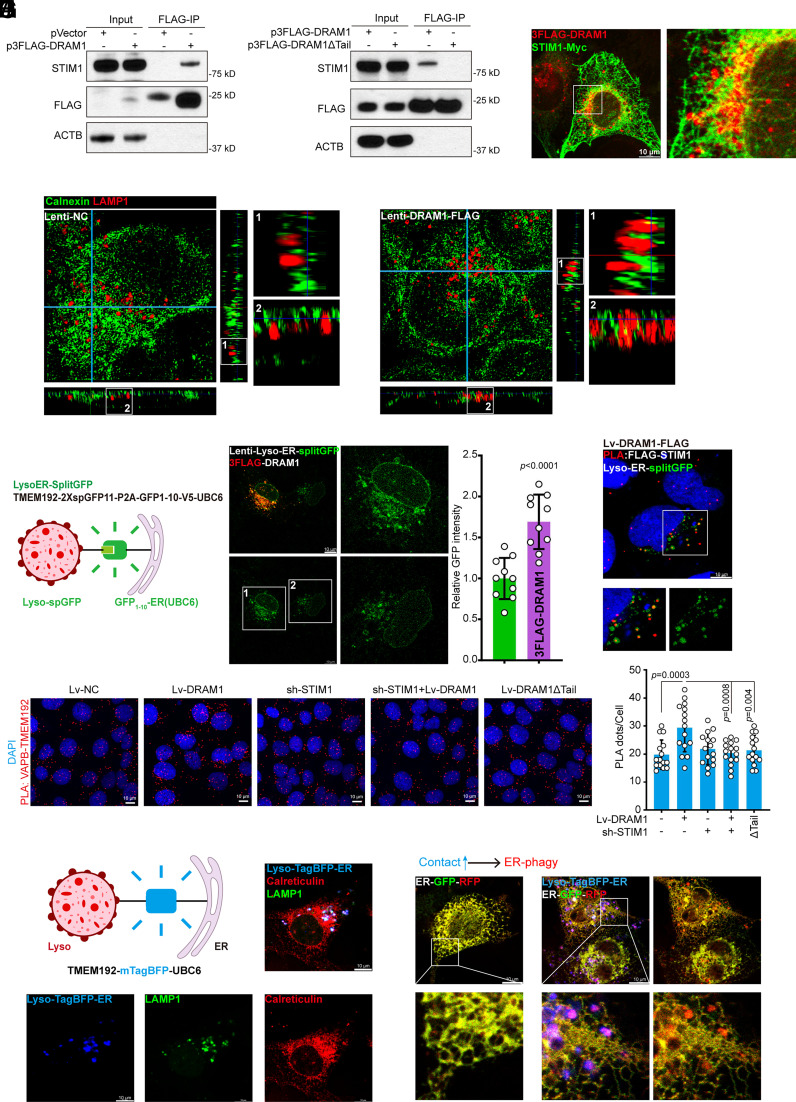 Figure 6 from: "The p53 target DRAM1 modulates calcium homeostasis and ER stress by promoting contact between lysosomes and the ER through STIM1" (PNAS 2024). Shows DRAM1 perturbation of Ca2+ homeostasis and DRAM1–STIM1 interaction (confocal images, co‑IP and Fluo‑2 Ca2+ imaging) relevant to p53 downstream control of organelle contact sites, calcium signaling and stress responses.