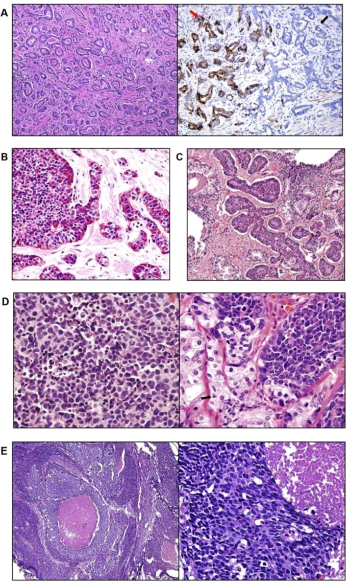 Functional sphere assays and progenitor expansion in Pten/TP53 null prostate (figure from Stem Cells, PubMed Central).
